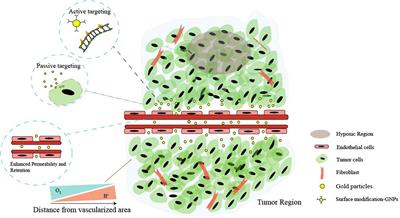 Gold Nanoparticles in Cancer Theranostics